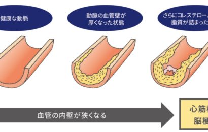 日本心臓リハビリテーション学会北海道支部